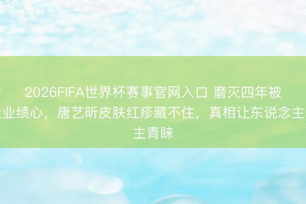 2026FIFA世界杯赛事官网入口 磨灭四年被嘲没业绩心,唐艺昕皮肤红疹藏不住,真相让东说念主青睐